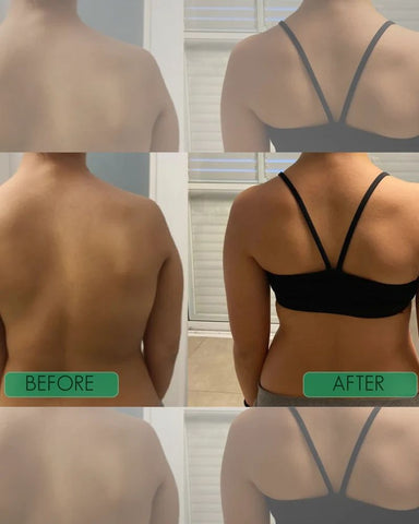 Adjustable Shoulder & Back Posture Corrector